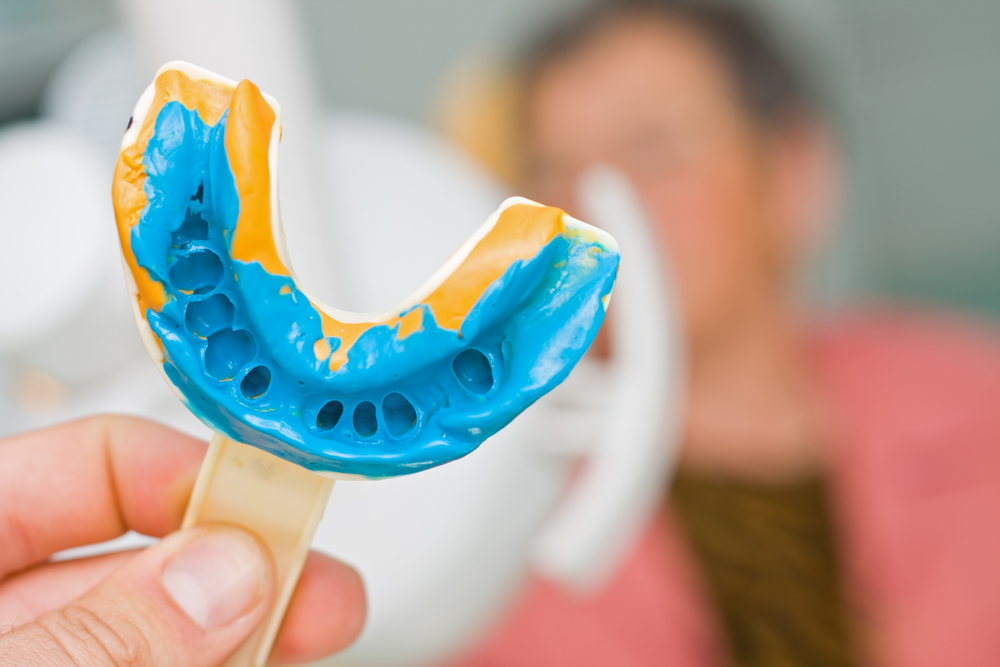 fpd reimagined and digital impression course