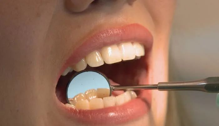 rotary endodontics and post and core course.jpg